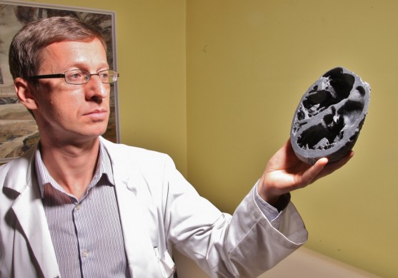 3D printēts sirds modelis operācijas veikšanai Stradiņos izmaksājis 2000 eiro 